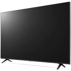 LG 65 UP 77506 LA LED-Телевизор